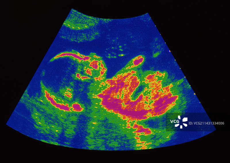 21周的胎儿图片素材