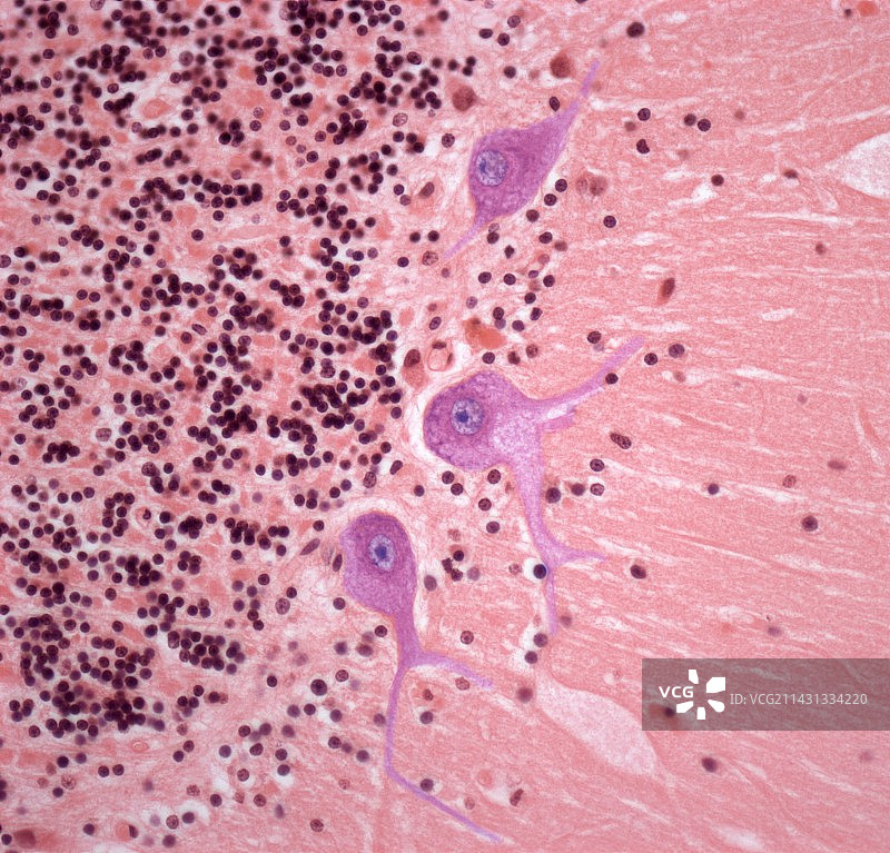 神经细胞中的糖分积累图片素材
