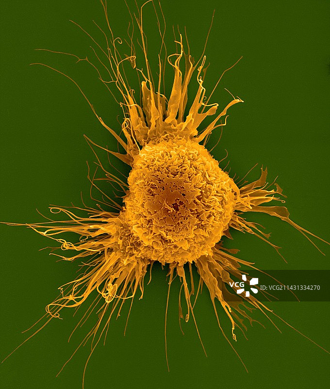 小鼠树突状细胞扫描电镜图图片素材