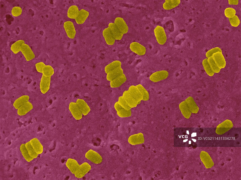 狂犬病毒扫描电镜图图片素材