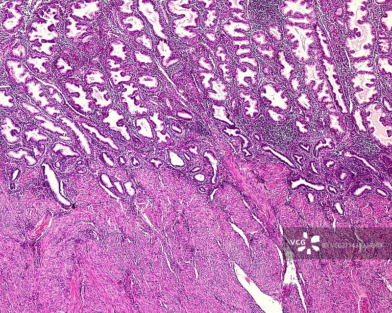 分泌期子宫内膜显微照片图片素材