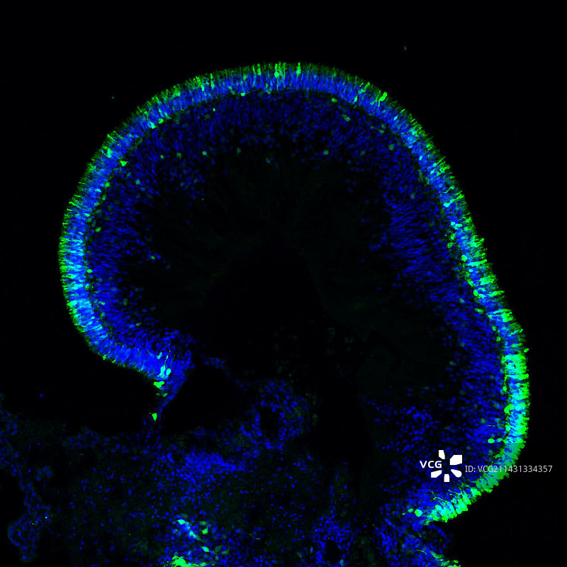 人类视网膜类器官荧光显微照片图片素材