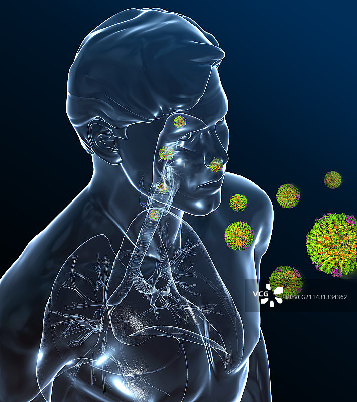 病毒性呼吸道感染，插图图片素材