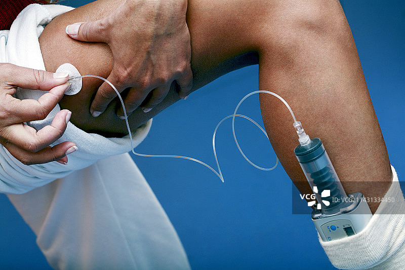 地中海贫血症治疗图片素材