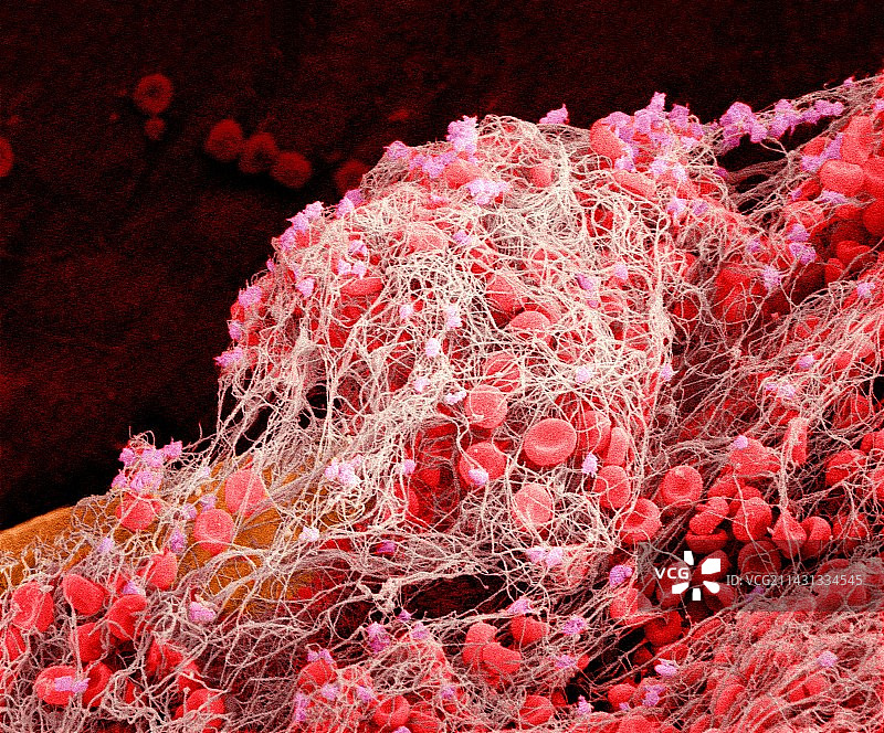 血栓扫描电镜图片素材