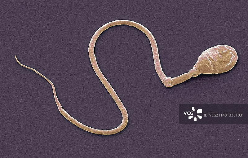 精子细胞扫描电镜图图片素材