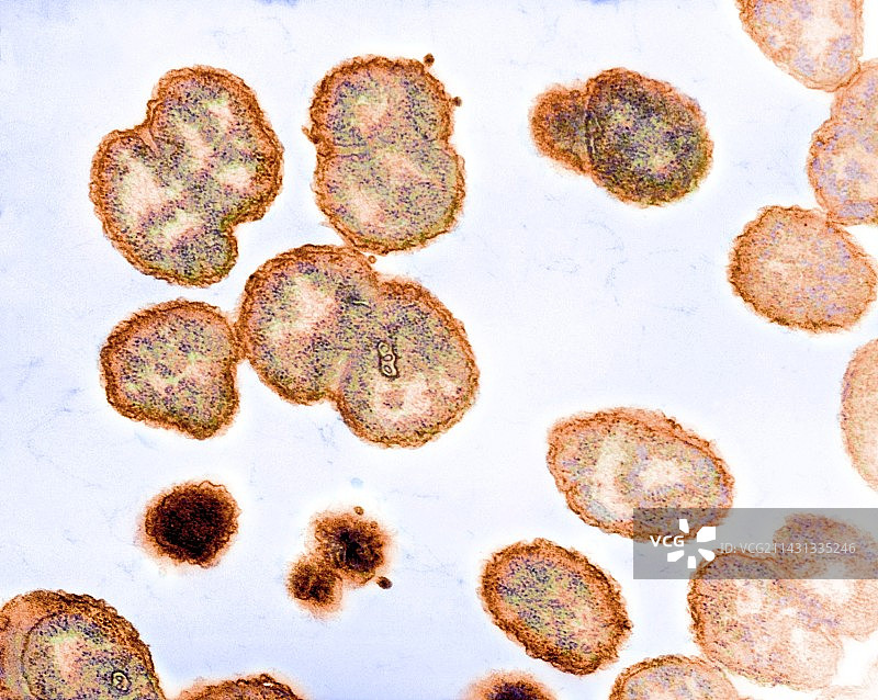 淋病奈瑟菌细菌，TEM图片素材