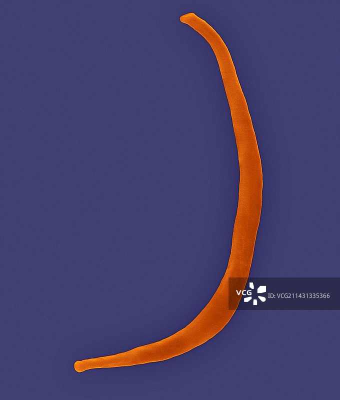 疟疾孢子（疟原虫属），扫描电镜图图片素材