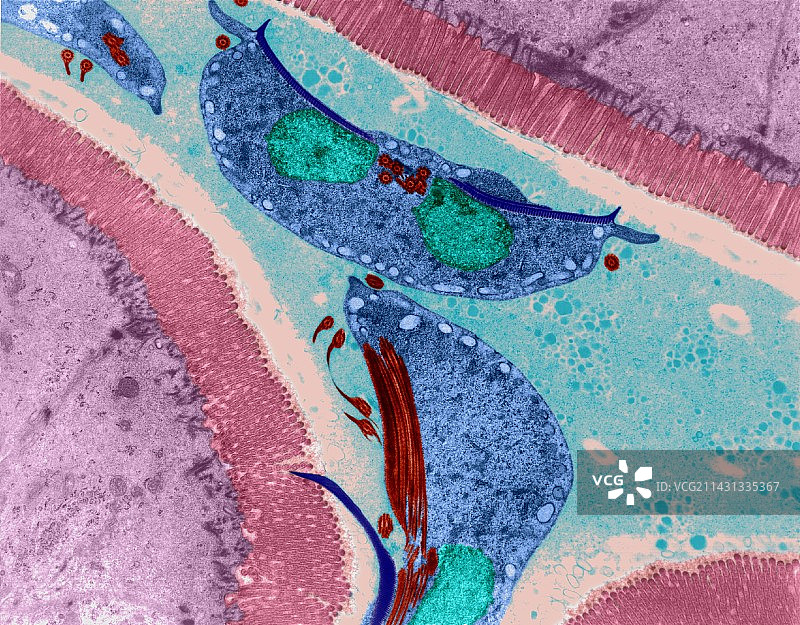原生动物肠道感染（贾第鞭毛虫属），TEM图片素材