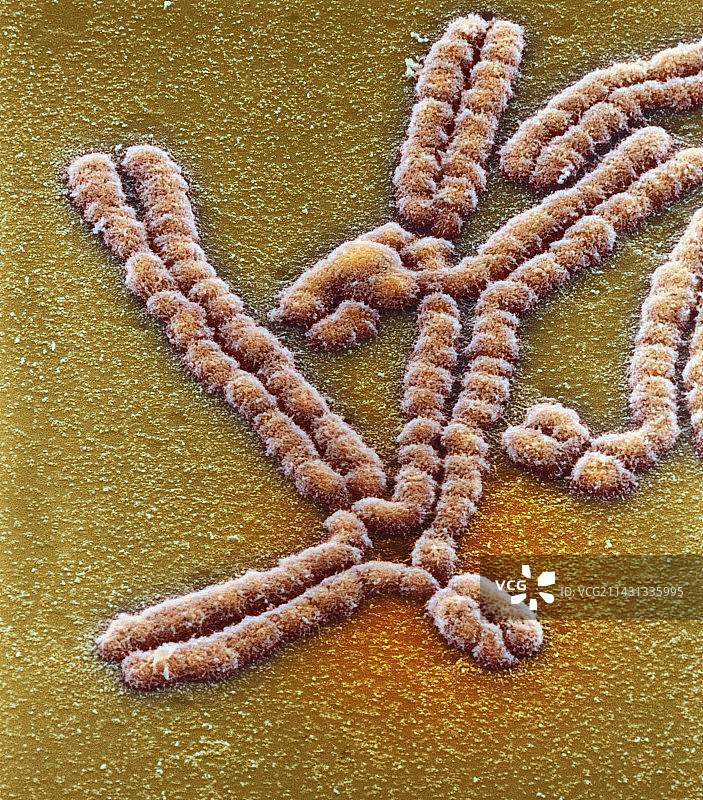 染色体重排，扫描电镜图片素材