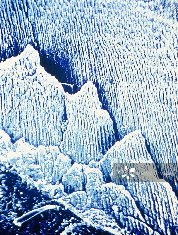 人牙釉质的伪彩色扫描电子显微镜图像图片素材