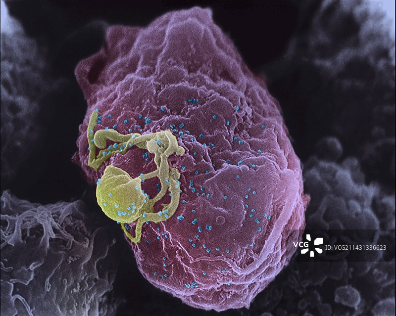 淋巴细胞中的艾滋病毒芽生，扫描电镜图片素材