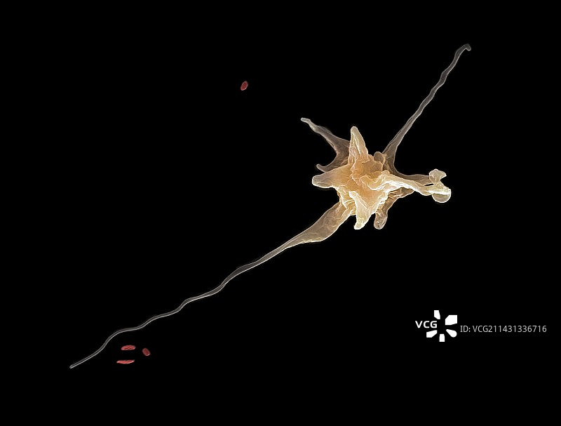 寄生变形虫扫描电镜图图片素材