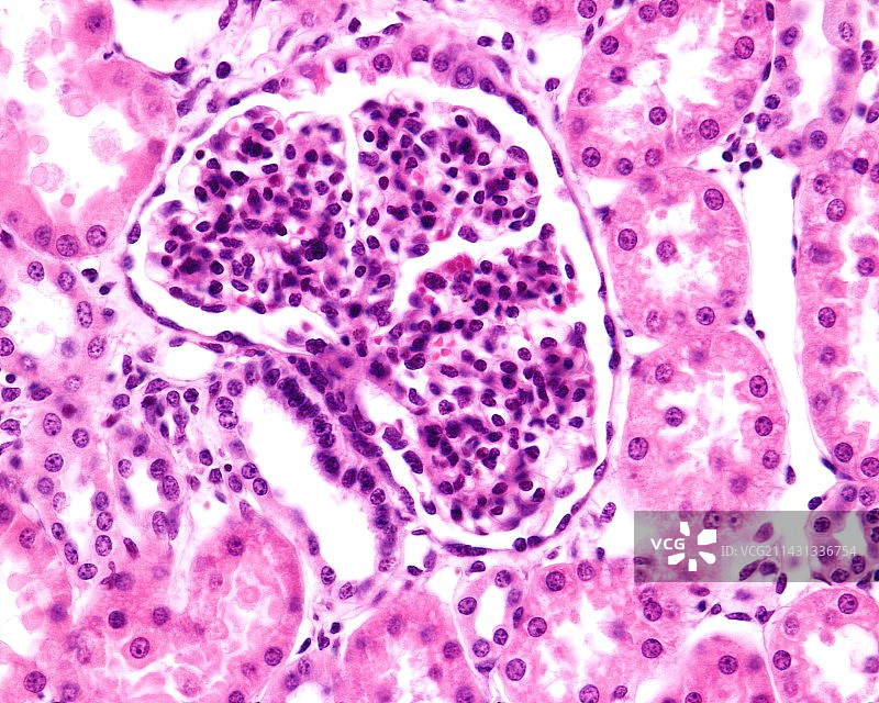 肾小球显微照片图片素材