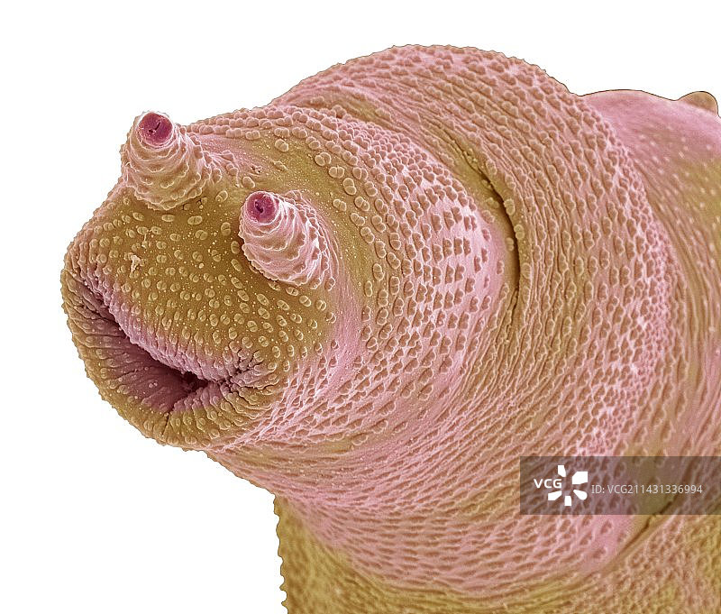 蛭形轮虫，扫描电镜图片素材