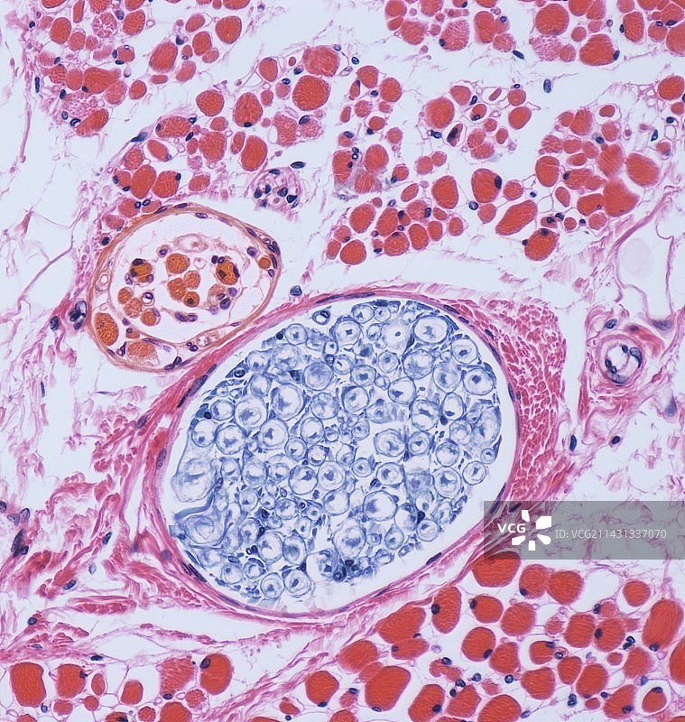 肌肉纺锤体，光学显微照片图片素材