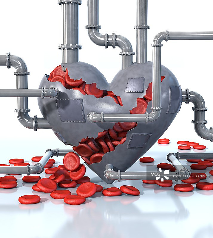 心血管疾病插图图片素材