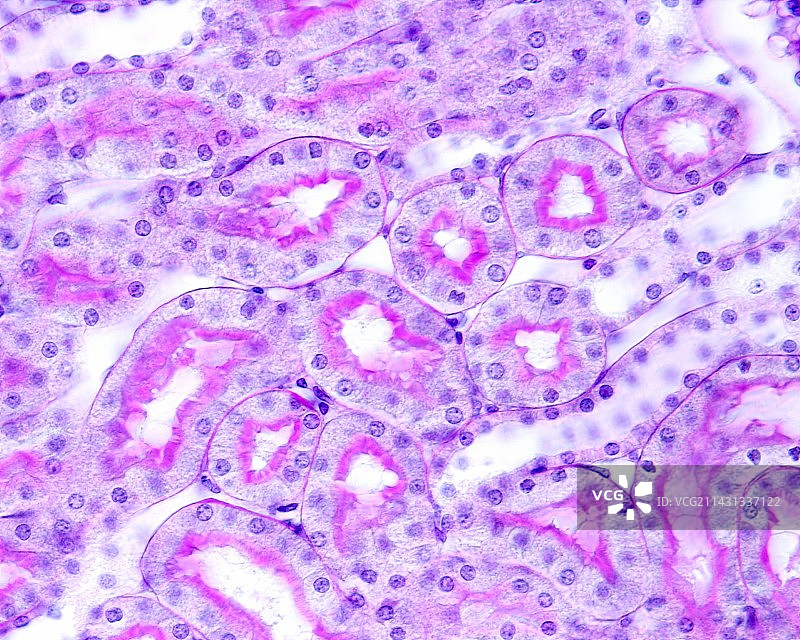 肾小管显微照片图片素材