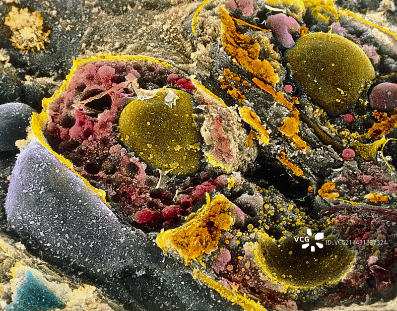 肾上腺分泌细胞的彩色扫描电镜图图片素材