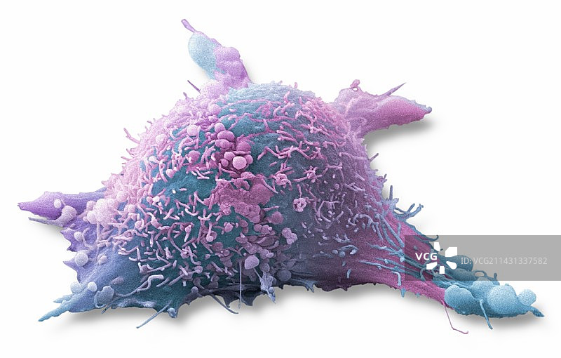 皮肤癌细胞，扫描电子显微镜图片素材