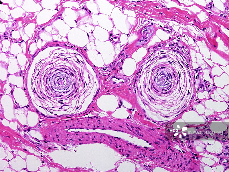 帕西尼小体，光学显微镜照片图片素材