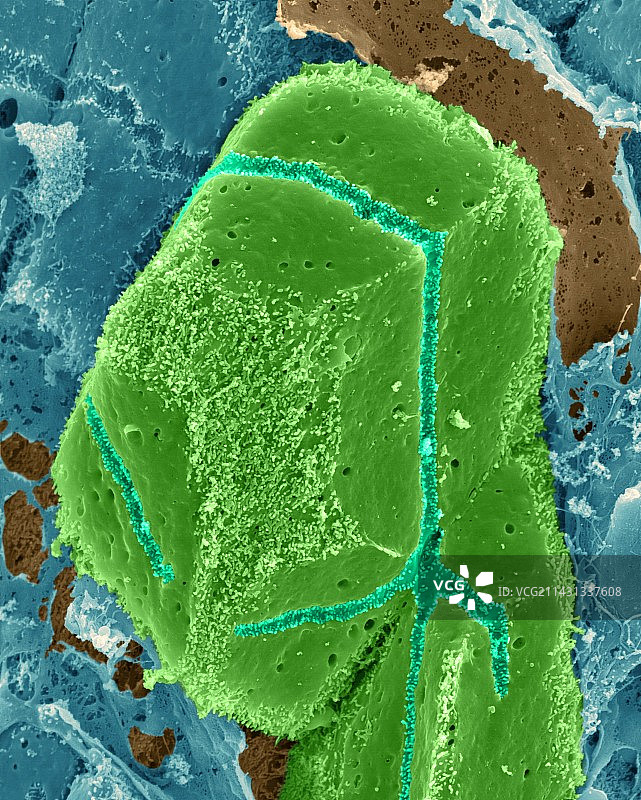 肝脏肝细胞扫描电镜图图片素材