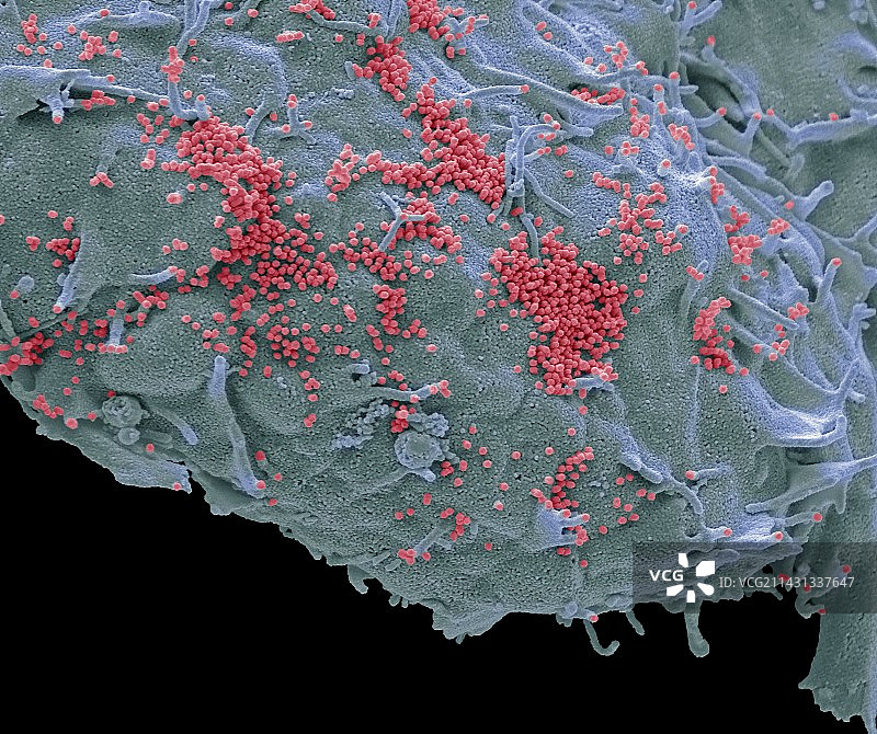 猪流感病毒，扫描电子显微镜图片素材