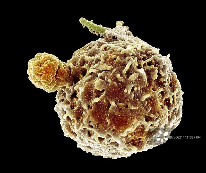 嗜中性粒细胞吞噬结核杆菌（扫描电镜图）图片素材