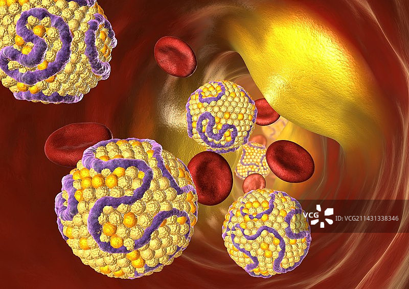动脉狭窄的电脑绘图图片素材