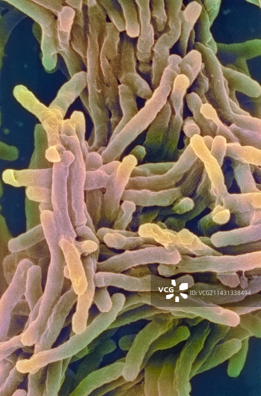 结核杆菌,扫描电子显微镜图片素材