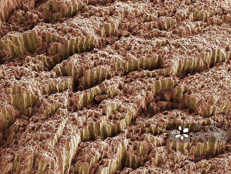 牙釉质扫描电镜图图片素材