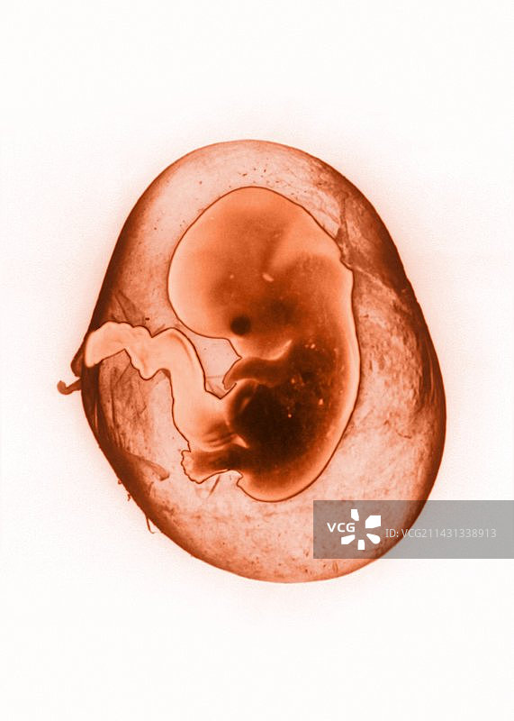 八周大的胎儿图片素材