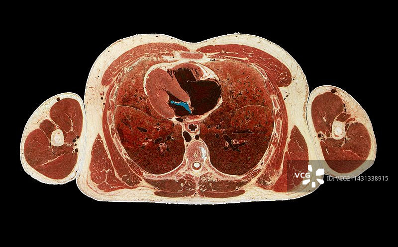 可见人体项目：男性胸部剖面图片素材