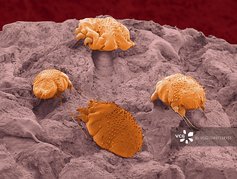 疥螨寄生虫(环境扫描电镜)图片素材