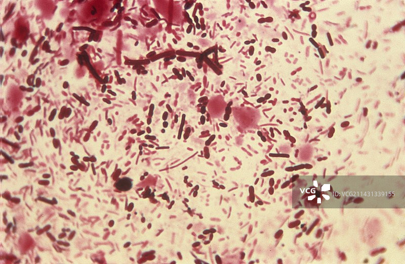 肠道细菌，光学显微照片图片素材