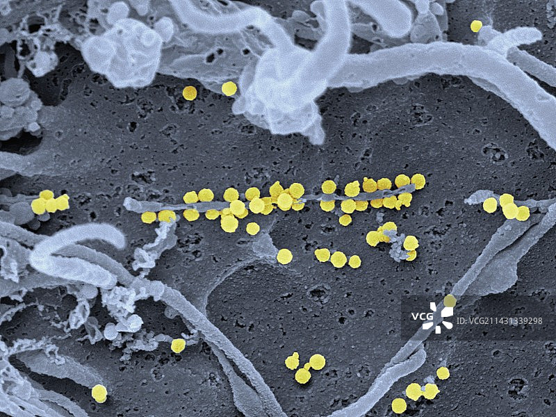 克里米亚-刚果出血热病毒扫描电镜图图片素材