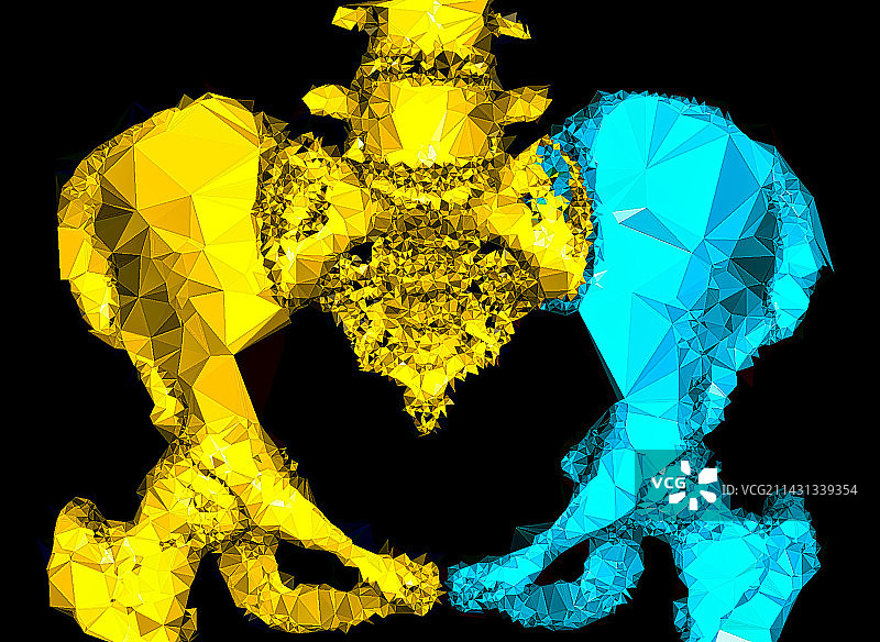 盆骨CT扫描图片素材