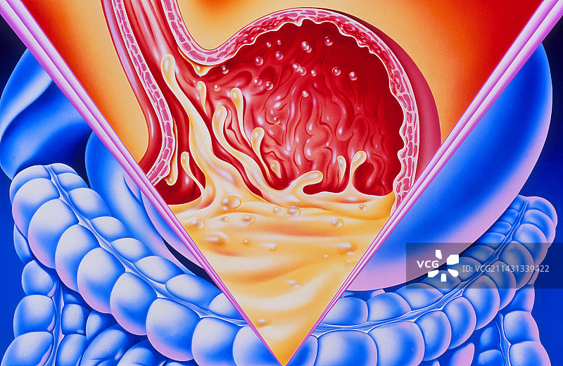 胃部消化不良的艺术作品图片素材