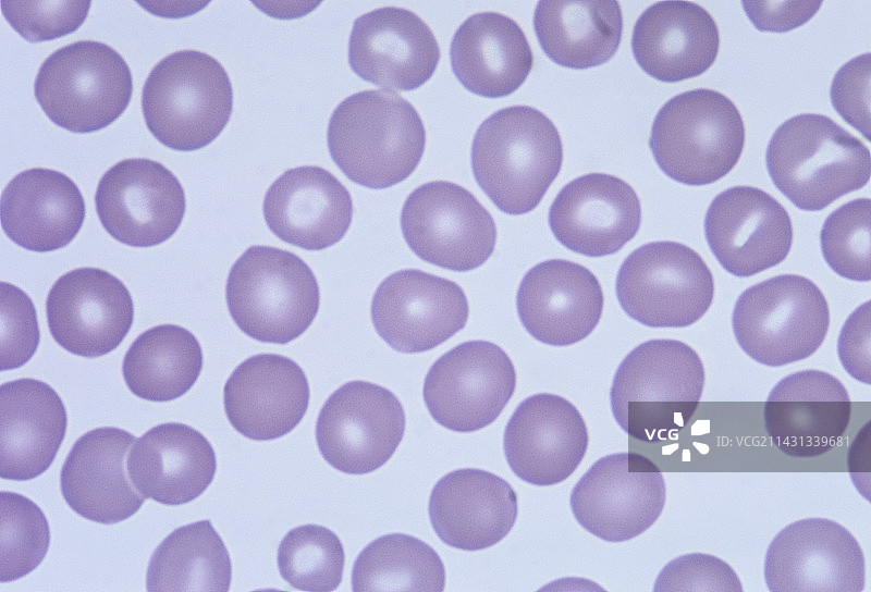 红细胞图片素材