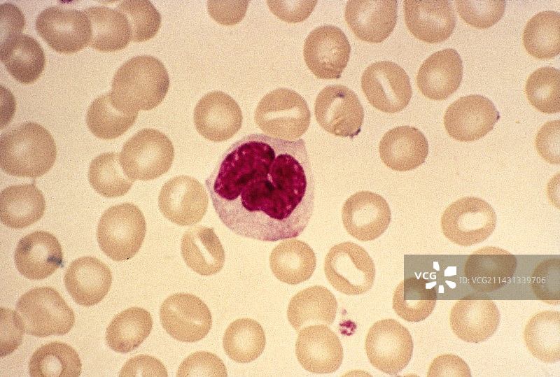 单核细胞血细胞显微照片图片素材