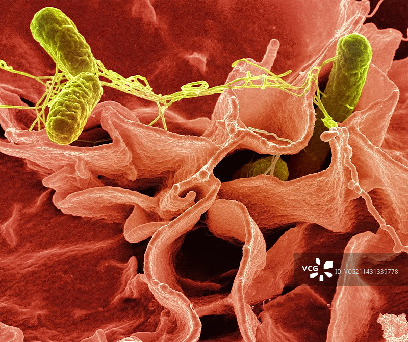 鼠伤寒沙门氏菌细菌扫描电镜图图片素材