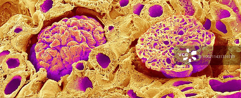 肾小球扫描电镜图图片素材