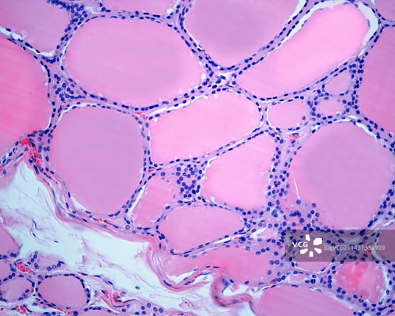 甲状腺滤泡显微照片图片素材