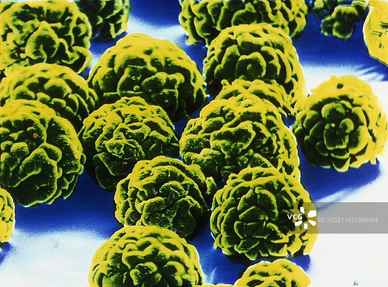 微载体颗粒上培养细胞的扫描电子显微镜图像图片素材