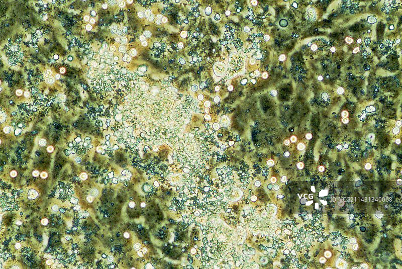 心脏干细胞显微照片图片素材