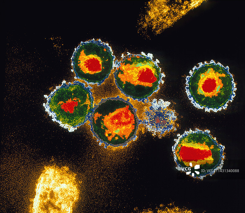 艾滋病毒（AIDS）的透射电子显微镜图像图片素材