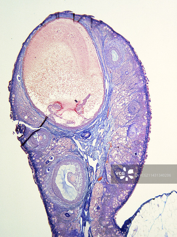 人类卵巢图片素材