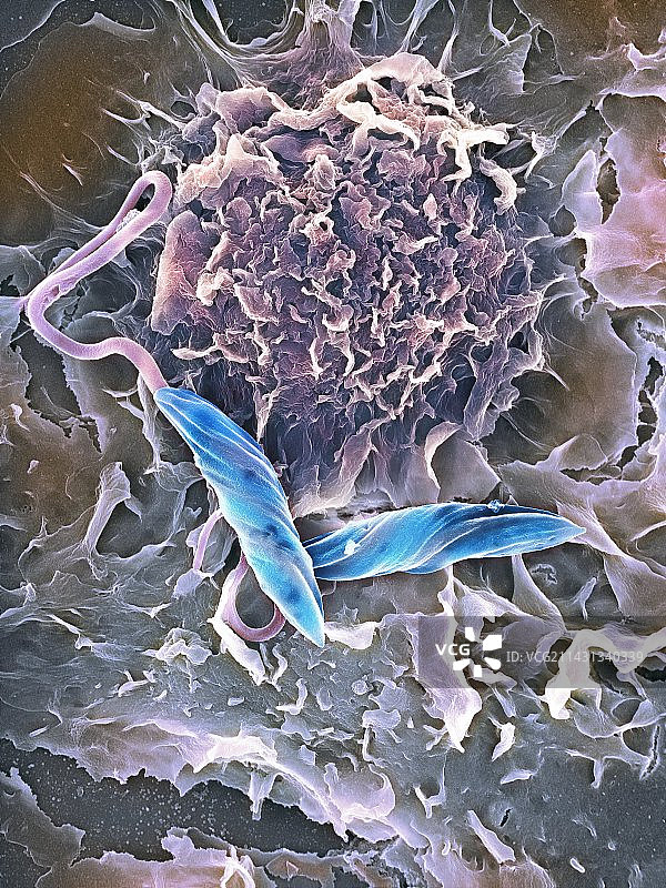 巨噬细胞攻击异物，扫描电镜图片素材