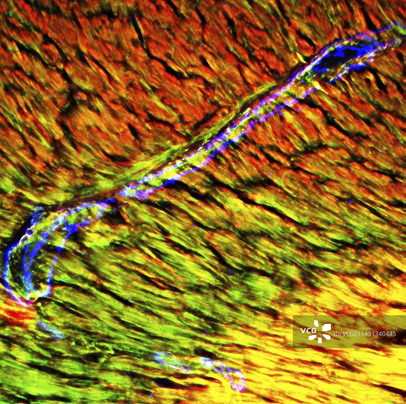 心脏微动脉荧光显微照片图片素材