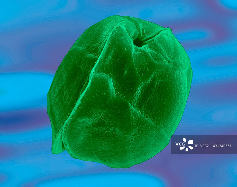 有毒双鞭甲藻扫描电镜图图片素材